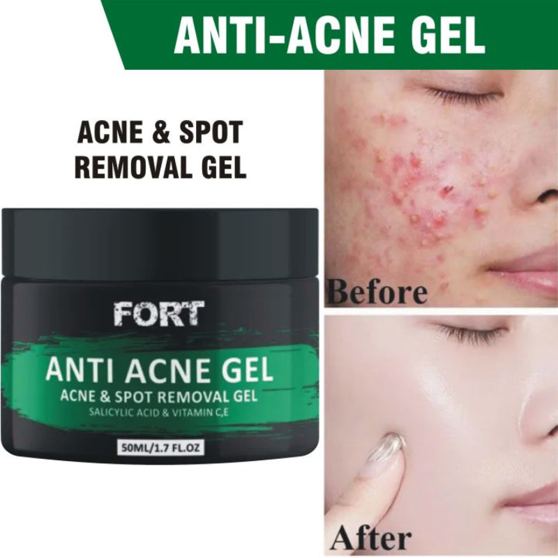 Fort Anti Acne Gel For Acne